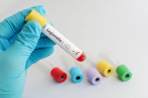 Legionella blood sample