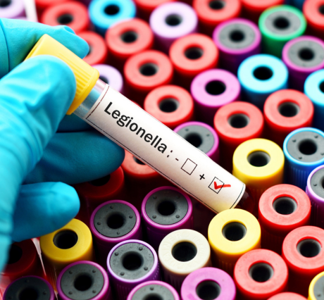 Legionella