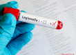 Legionella Management